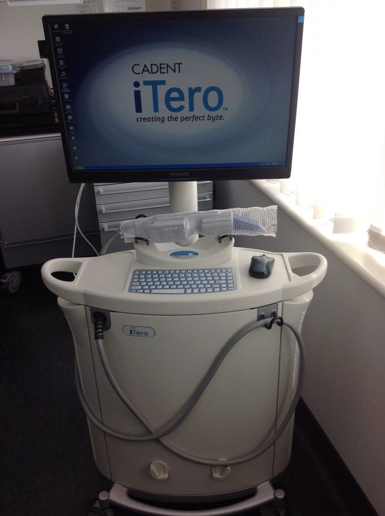 Itero scanner picture